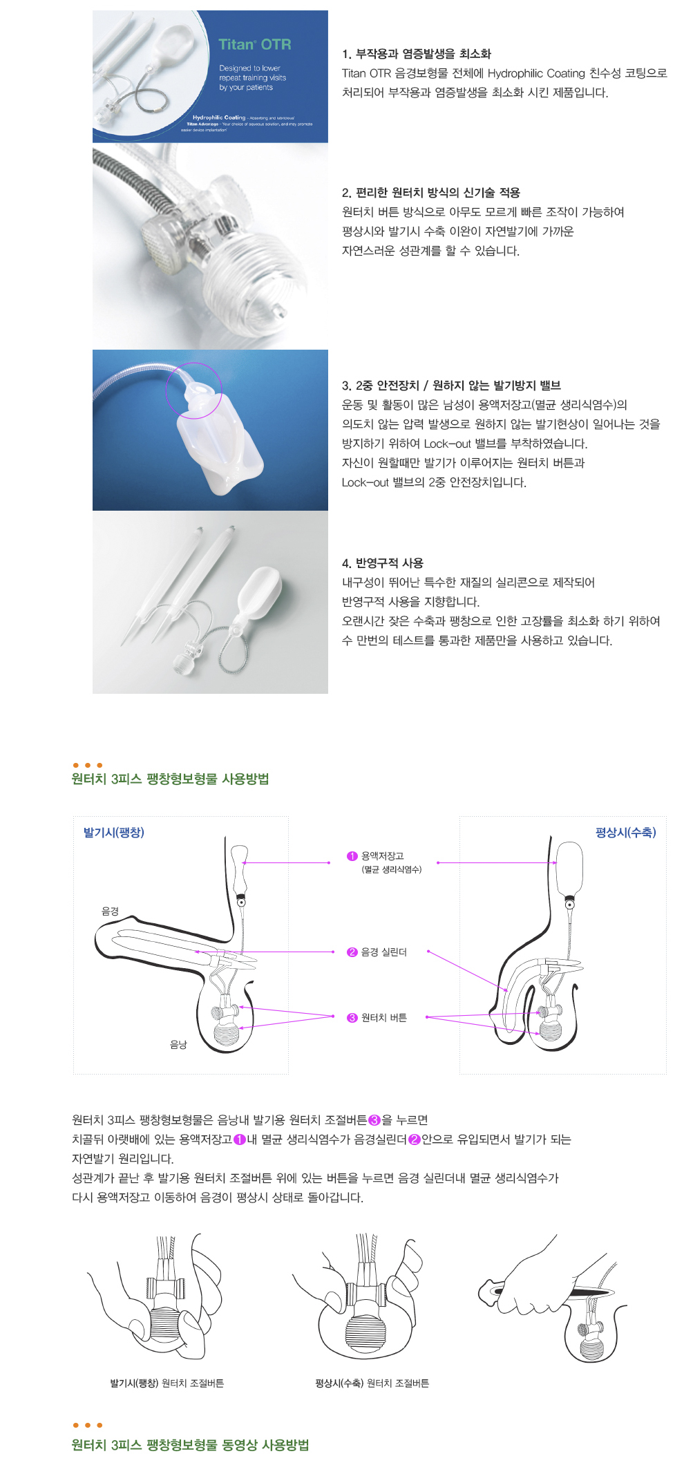 발기보형물 수술